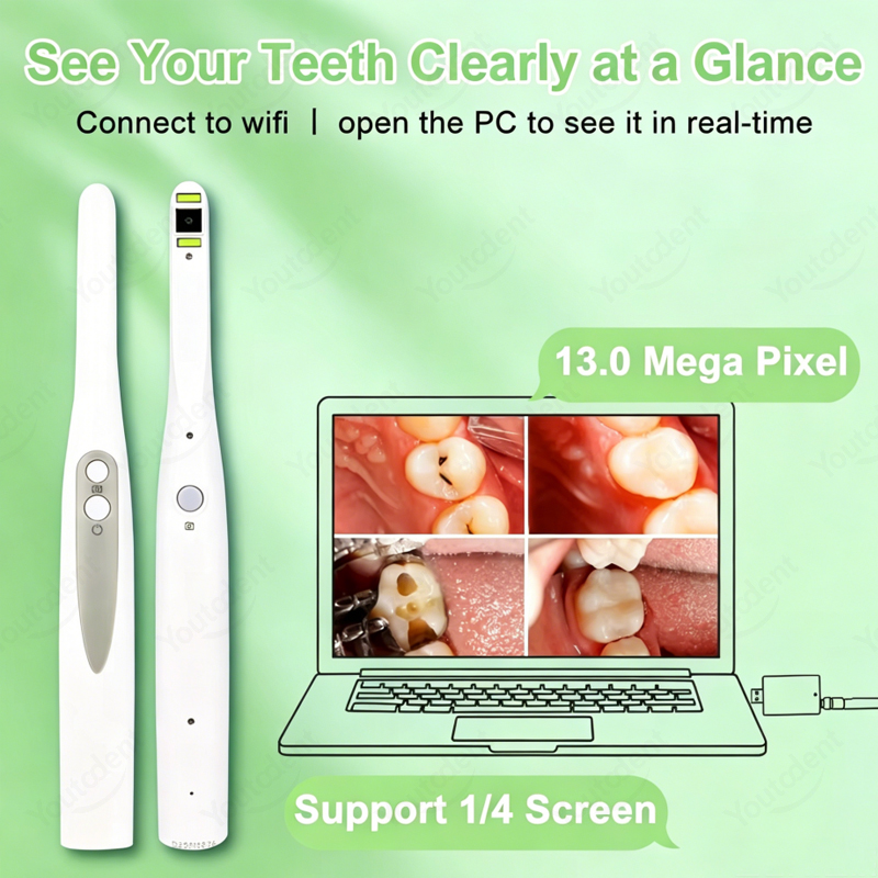 Wireless WIFI Dental Intraoral - Endoscope Inspection Camera ulasan dan harga